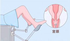 成都锦江妇幼提示：预防宫颈癌，HPV、TCT检查很